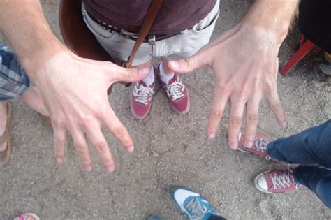 Fingers Feel Swollen After Walking at Rita Skelley blog