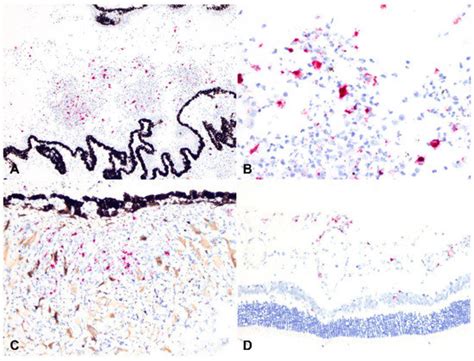 Pathogens | Special Issue : Advances on Feline Coronavirus Infection