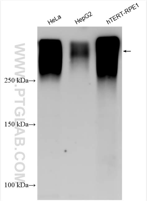 Piezo1 (extracellular domain) antibody (28511-1-AP) | Proteintech