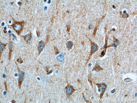 Sortilin antibody (12369-1-AP) | Proteintech