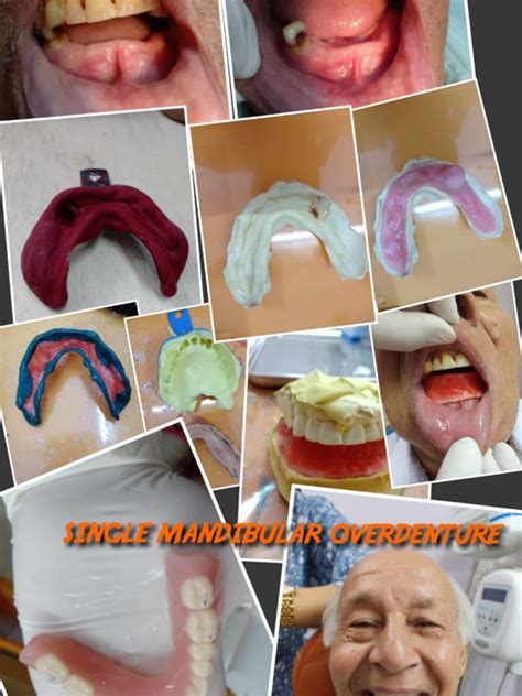 US Bench Test Preparation - Delhi Dental Academy