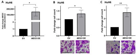 Upregulation of the lncRNA MEG3 in Metastatic Hepatoblastoma