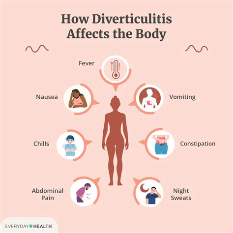 Diverticulitis: Signs, Symptoms, and Diagnosis