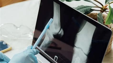 NIT Rourkela researchers develop natural bio-ink for 3D bioprinting of ...