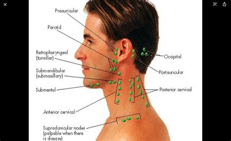 Head and neck lymph nodes | Lymph massage, Lymph nodes, Neck muscle anatomy