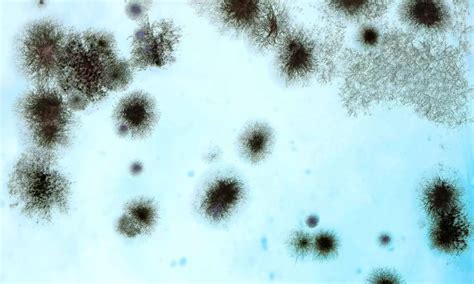 Study Shows Fungal Spores in the Air Can Help Predict Flu and COVID-19 ...