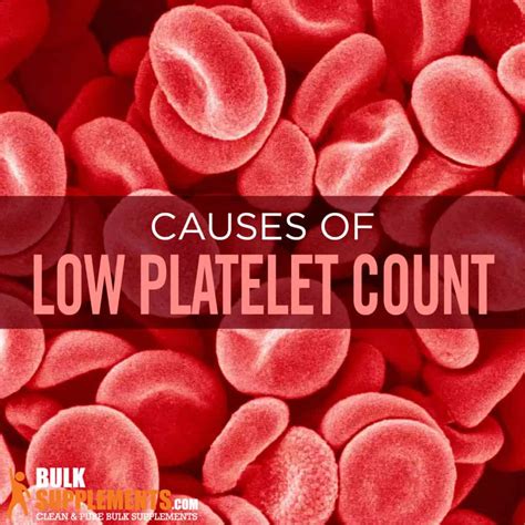 Low Platelet Levels Symptoms _ Low Platelets And Abdominal Pain: Is ...