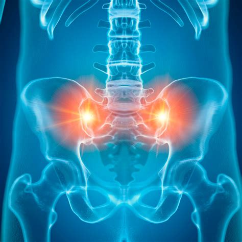 Sacroiliac Joint Pain Relief