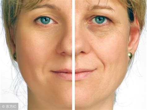 脸上长皱纹的原因 7种方法快速去除皱纹更高效 - 知乎