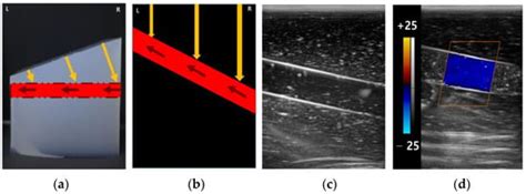 Development and Evaluation of Doppler Ultrasound Training Phantom for ...