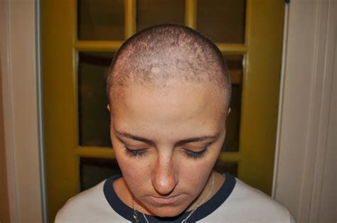 Carri Us Home: Chemo #2 & I'm Losing My Mind...and My Hair!
