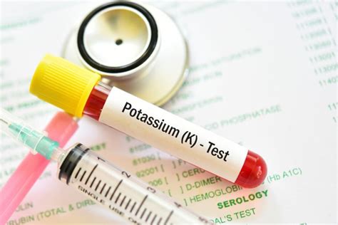 Image result for How to Check Potassium Levels