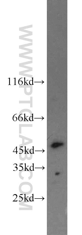 ING3 antibody (10905-1-AP) | Proteintech