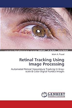 Buy Retinal Tracking Using Image Processing Book Online at Low Prices ...