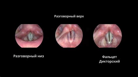Типы смыкания голосовых связок/складок. Режимы. - YouTube