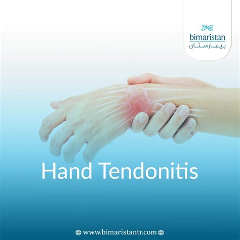 Hand Tendonitis Symptoms and Treatment Options in Turkey