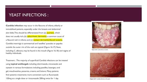 Fungal-Infections.pptx- fungal infections a lecture for students | PPTX