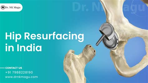 Hip Resurfacing Cost in India | Dr. Narender Kumar Magu