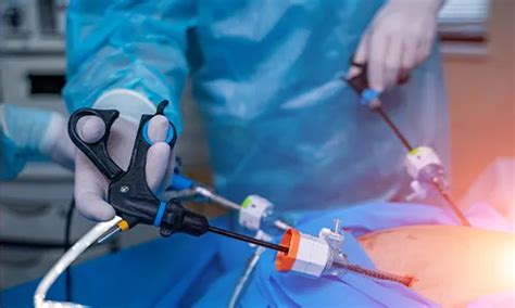 Stomach Cancer: Symptoms, Diagnosis, Treatment, and Prevention - MOC