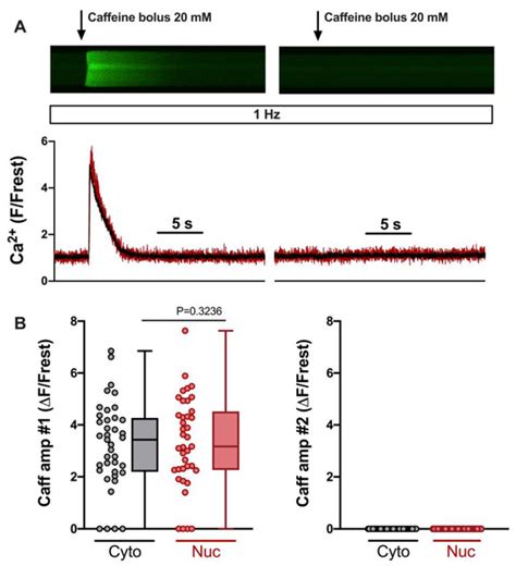 Store-Operated Calcium Entry Increases Nuclear Calcium in Adult Rat ...