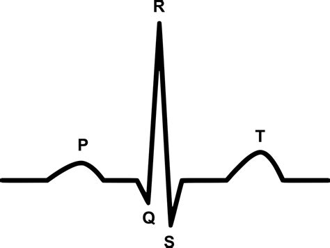 Which of the following labels show the only repolarization wave in the ...
