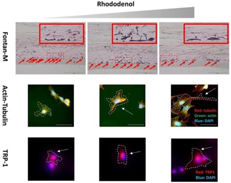 Rhododenol Activates Melanocytes and Induces Morphological Alteration ...