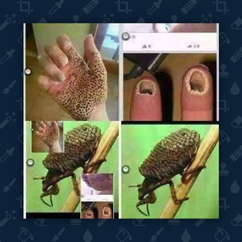 What Is The Fear Of Holes In Skin at Helen Shields blog