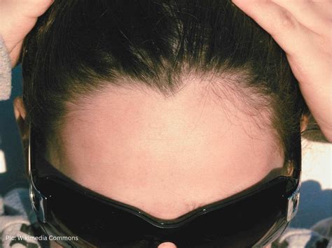 10 Spiritual Meanings of Widow’s Peak, Symbolism & Myths - What Spiritual
