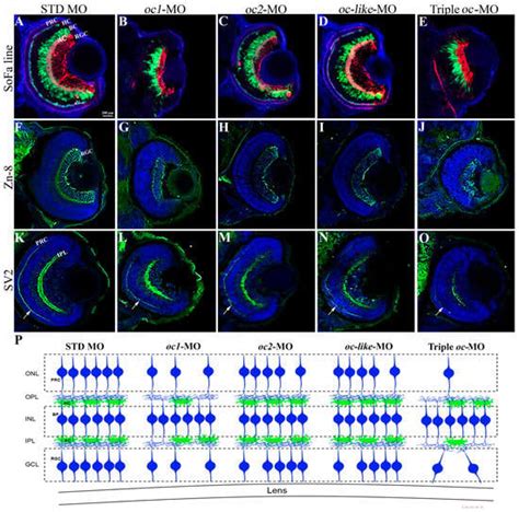 The Zebrafish Retina and the Evolution of the Onecut-Mediated Pathway ...
