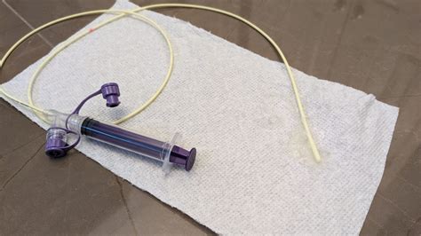 When You Have to Place a Baby Feeding Tube, Part II: How to Insert a ...