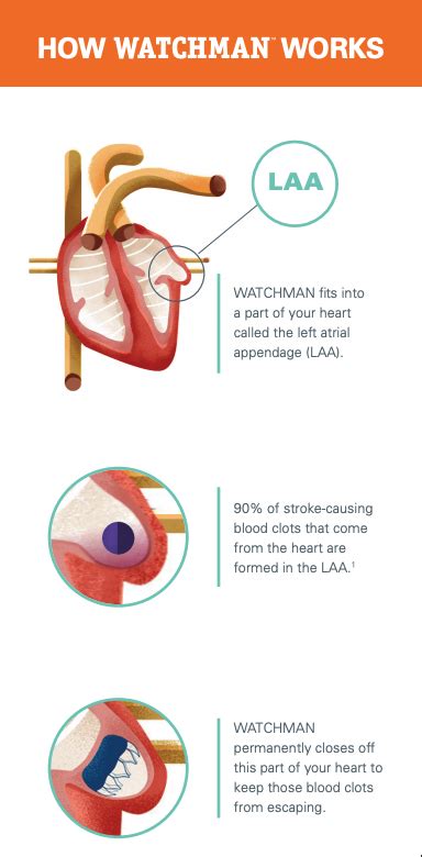 Image result for Video Watchman Device.com