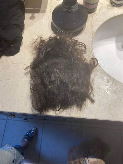 What Does Hair Regrowth After Chemotherapy Look Like?