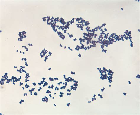 Staphylococcus Aureus Under Microscope 的图像结果