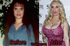 Coco Austin Plastic Surgery: Boob Job, Butt, Before and After. 
