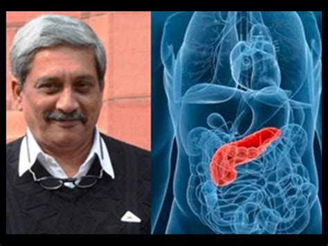Pancreatic Cancer: मनोहर पर्रिकर जूझ रहे थे पैंक्रियाटिक कैंसर से, इस ...
