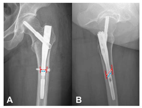 Cephalo Medical Term