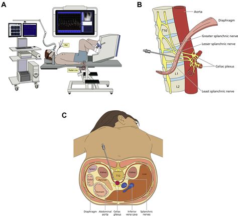 Splanchnic Nerve Block for Chronic Heart Failure | JACC: Heart Failure