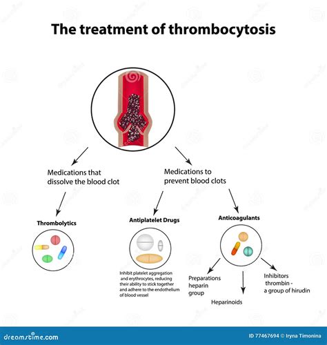 The Treatment of Thrombocytosis. Embolism. Infographics. Vector Illustration on Isolated ...