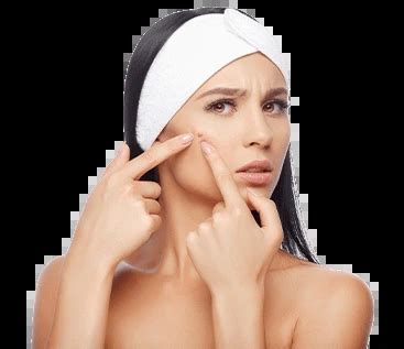 Mole Removal in Chennai | Laser Mole Removal Treatment & Cost