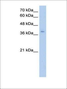 PCBP2 (AB2) antibody Western AV40567