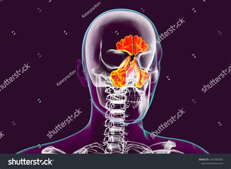 1,839 Sinuses 3d Images, Stock Photos & Vectors | Shutterstock - illustration of sinuses