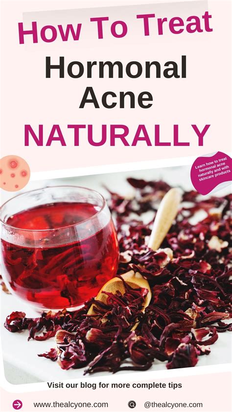 How To Treat Hormonal Acne Naturally & Skincare Products