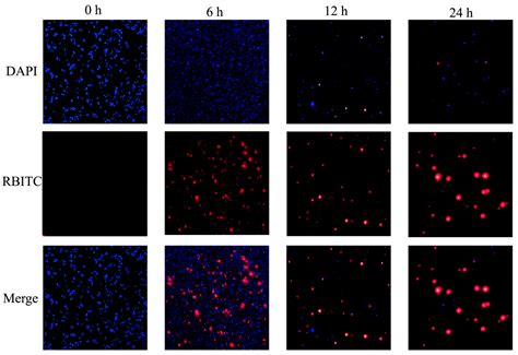 Construction of Chitosan/Alginate Nano-Drug Delivery System for ...