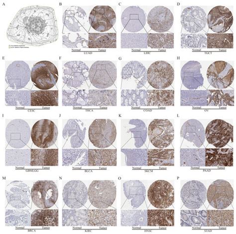 Cancers | Special Issue : Metabolic Alterations in Cancer