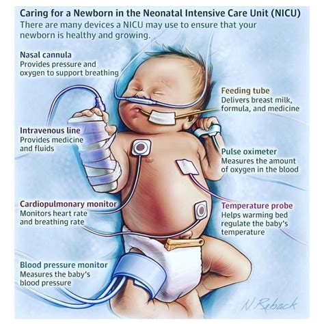 Nicu advice from nicu nurses for nicu parents – Artofit