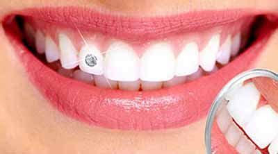 Orthodontist in Ranchi, Dental hospital in Ranchi, Sushruta Dental
