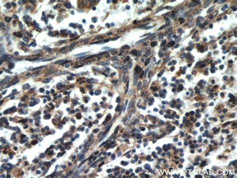 CCR10 antibody (22071-1-AP) | Proteintech