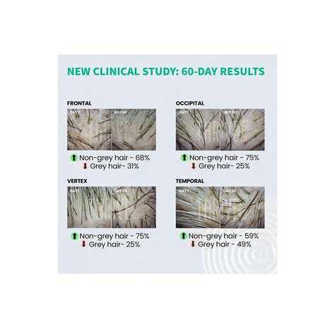 ThriveCo Anti-Greying Hair Prime Serum 30ml - Cureka