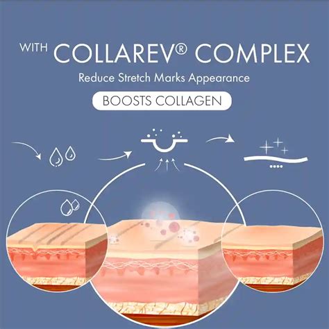 Best Stretch Marks Removal Cream for Women & Men | ThriveCo