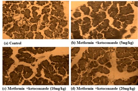 Evaluation of antifertility potential of ketoconazole and assessment of ...